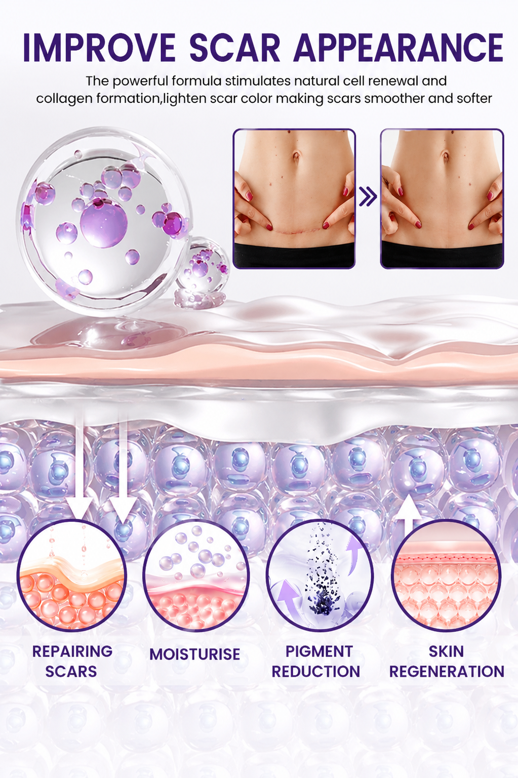 Timilk Regenscar Stem Cell Scar Gel