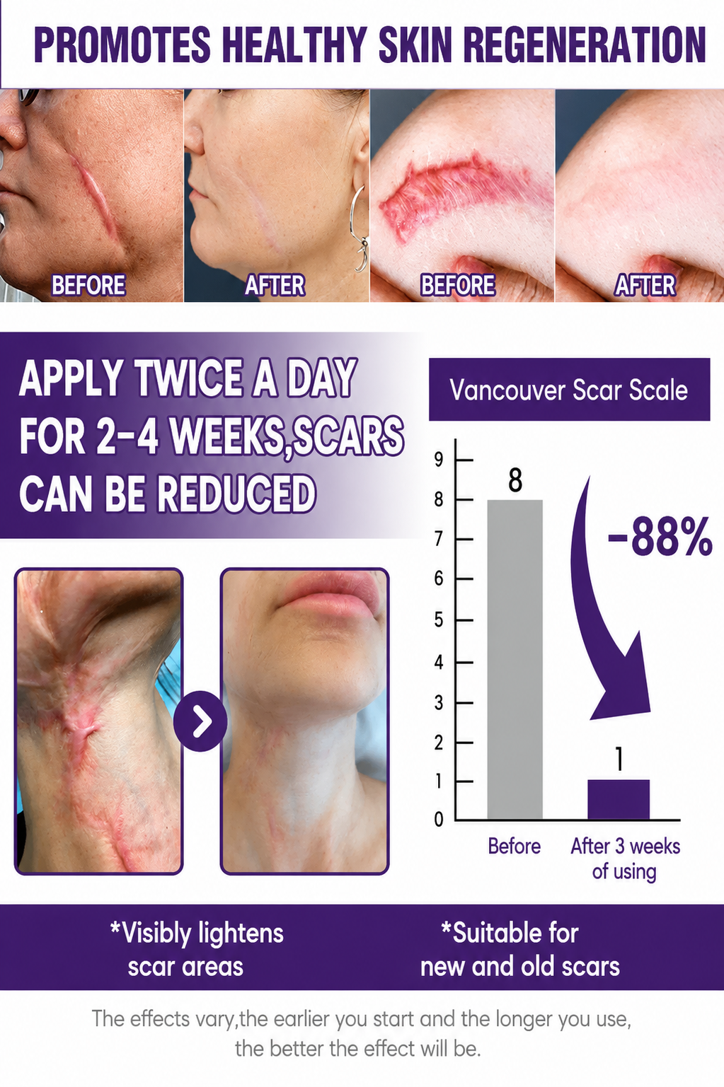 Timilk Regenscar Stem Cell Scar Gel